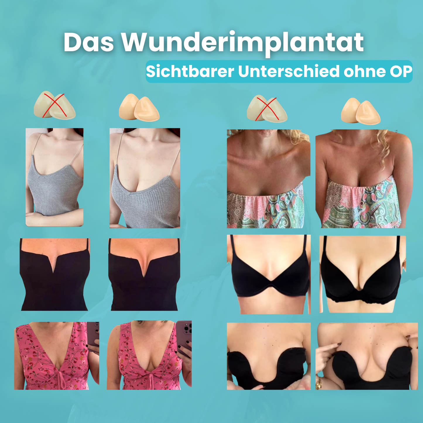 Die Wunderimplantate