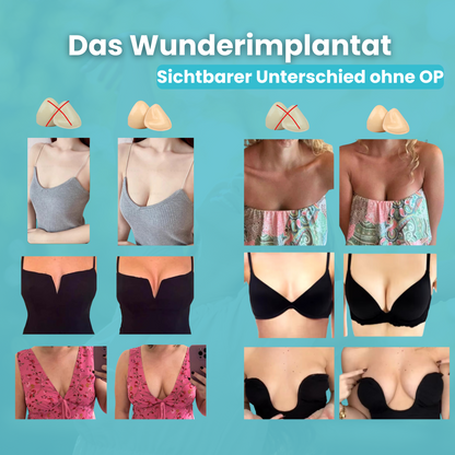 Die Wunderimplantate
