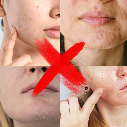 WellSkin - schneller als Dein Dermatologe 💁‍♀️
