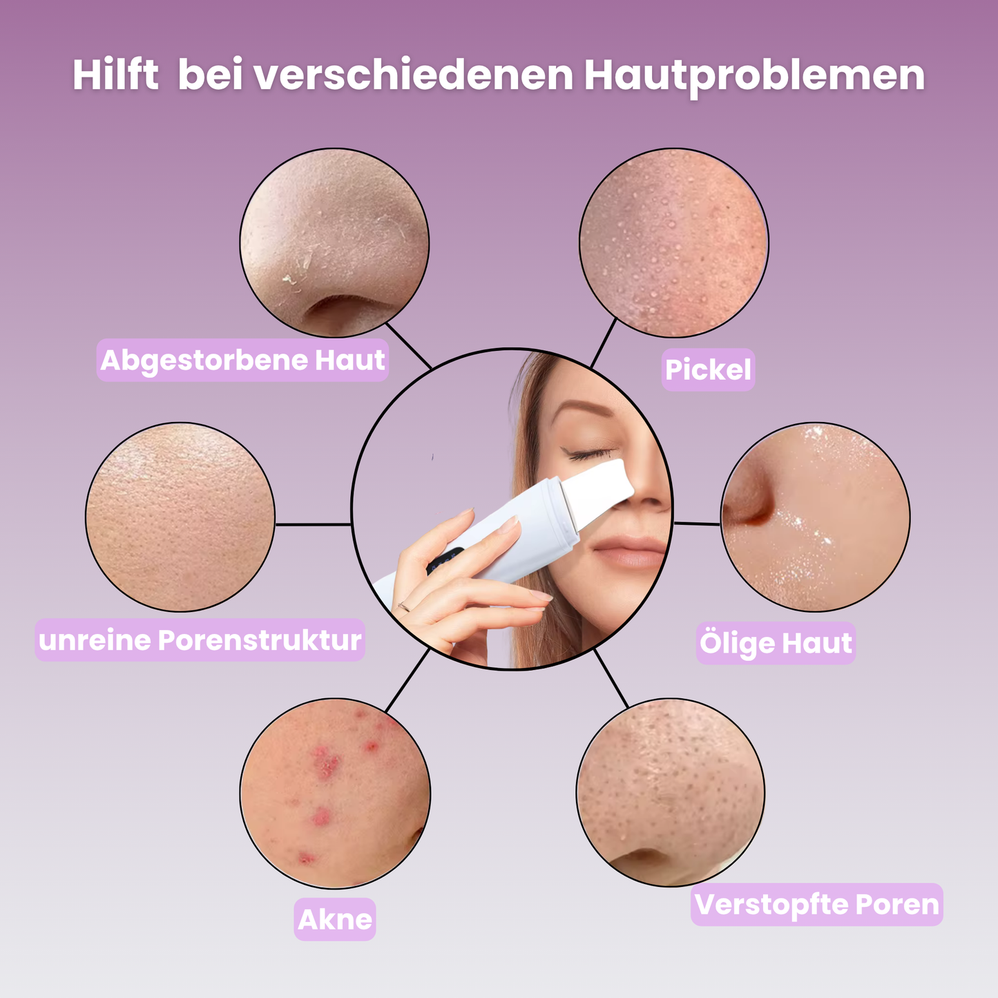WellSkin - schneller als Dein Dermatologe 💁‍♀️